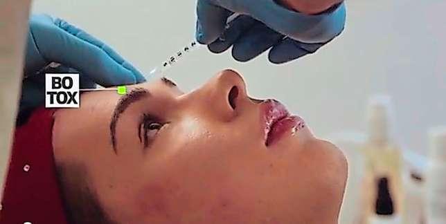 SRF: Unerlaubte Botox-Werbung