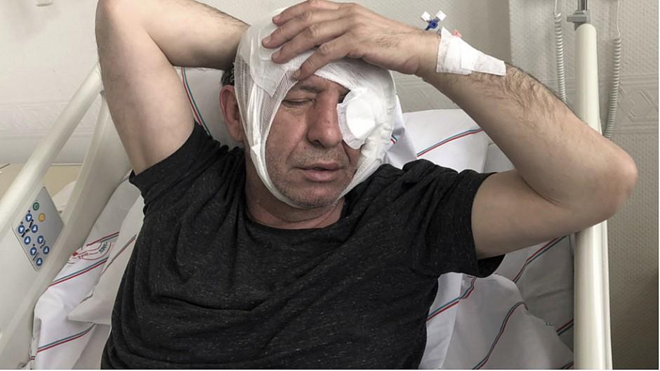 Türkei: Festnahmen nach Angriff auf Journalisten