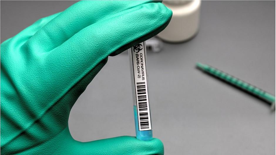 Mindnow: Lockerungen durch digitale Selbsttests